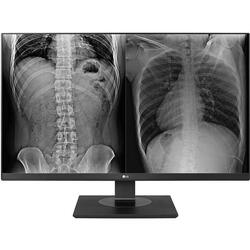 Monitor medical profesional IPS LED LG 27" 27HJ713C-B, UHD (3840 x 2160), HDMI, DisplayPort, Pivot, Negru